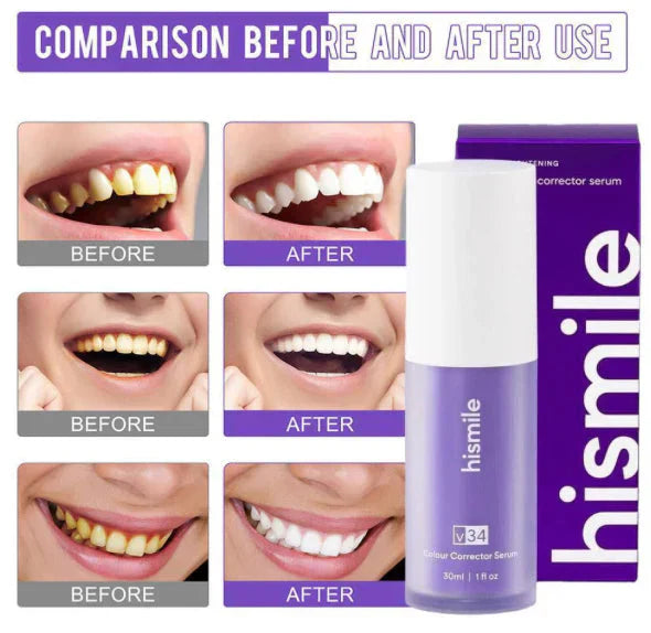 30ml V34 Purple Teeth Whitening Toothpaste